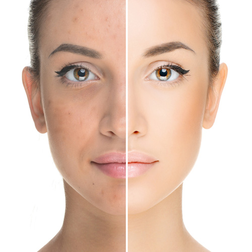 forkorte fordel adjektiv 3D SKIN REJUVENATION SQUARE • Skin Solution Clinic
