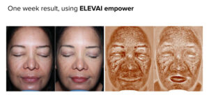Evolve Skincare before and after
